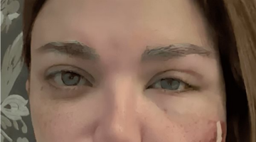 ياسمين الخطيب تخضع لجراحة عاجلة وتكشف تأثر جدول أعمالها الرمضاني